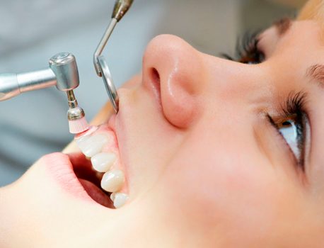 Limpeza Dental