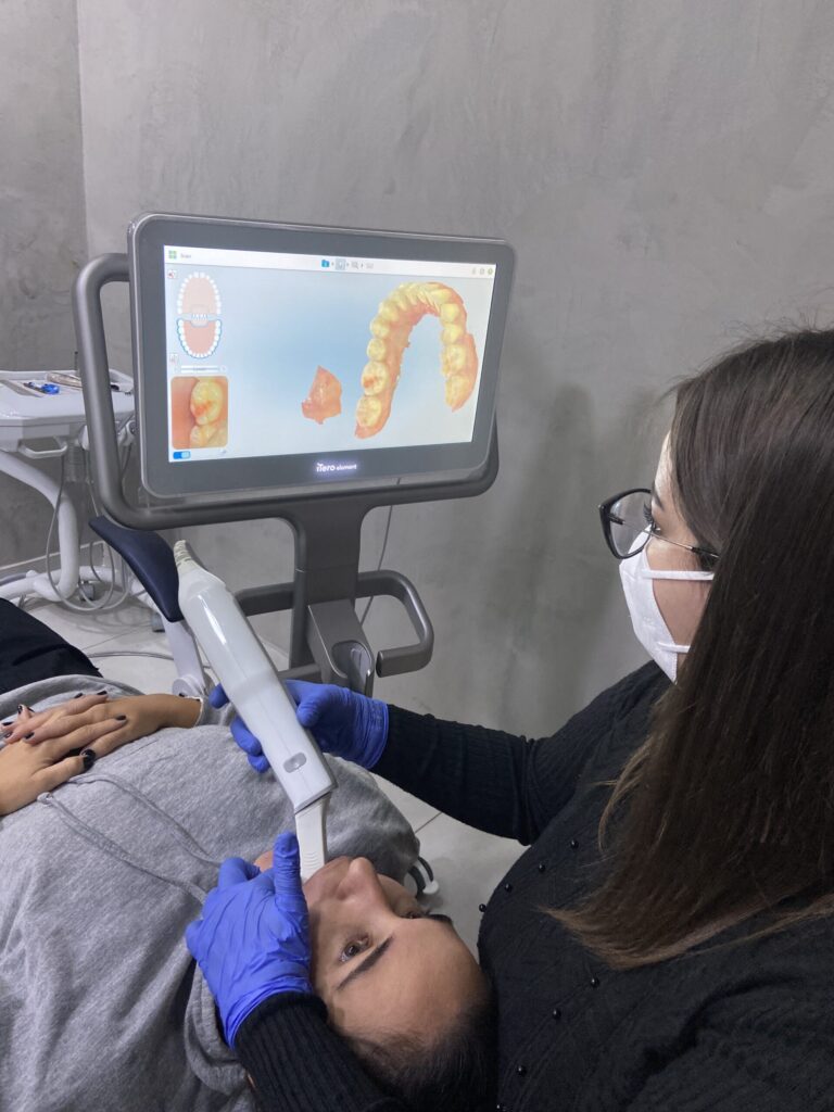 implantes dentários em botucatu