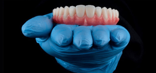 implante dentario botucatu
