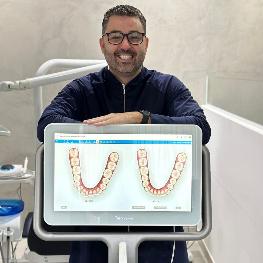 escaneamento intra oral itero botucatu dr gabriel barberio