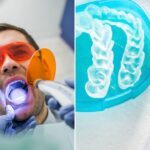 clareamento-dental-misto botucatu